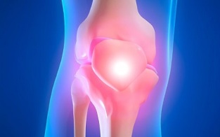 causes of osteoarthritis of the knee