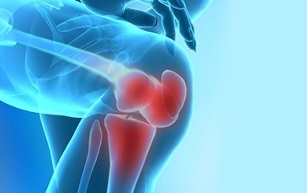 how osteoarthritis of the knee joint is manifested