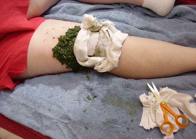 A warm compress with crushed cabbage leaves on a sore knee joint with arthrosis